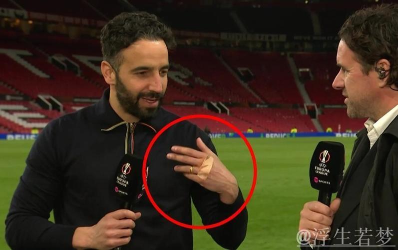 阿莫林拳头现新伤痕疑再怒！不满曼联阵容认同名宿批评